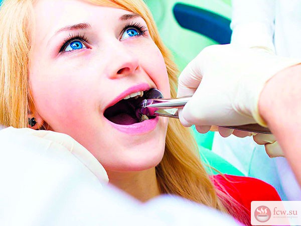Осложнения после удаления зуба и их профилактика