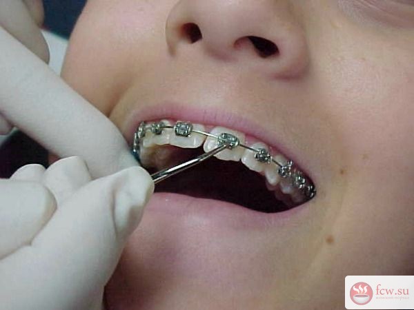 Неровные зубы - повод задуматься о здоровье